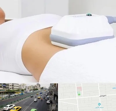 لاغری موضعی در خیابان دامپزشکی
