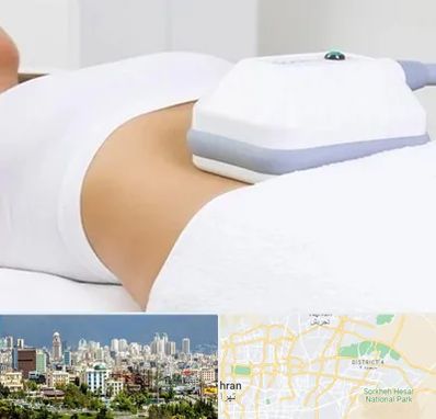 لاغری موضعی در شرق تهران 