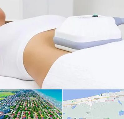 لاغری موضعی در فریدونکنار