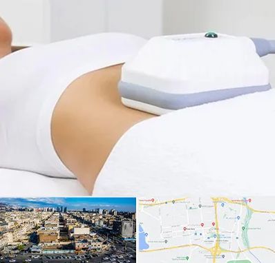 لاغری موضعی در شهرک راه آهن 