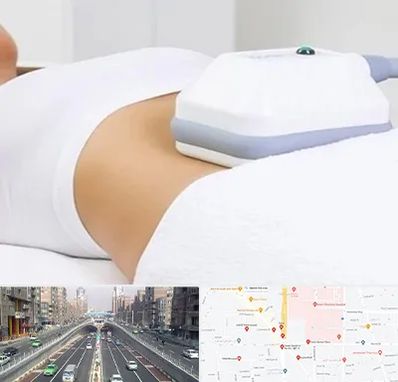 لاغری موضعی در توحید 