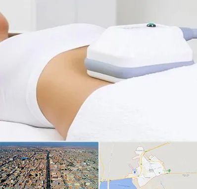 لاغری موضعی در بندر ماهشهر