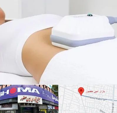 لاغری موضعی در امین حضور