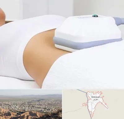 لاغری موضعی در اسفراین