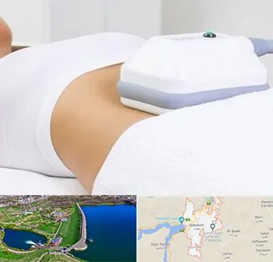 لاغری موضعی در مهاباد