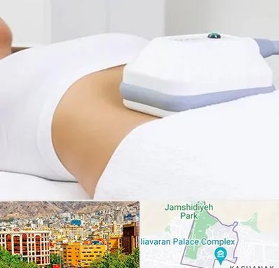 لاغری موضعی در نیاوران 