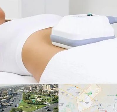 لاغری موضعی در کمال شهر کرج 