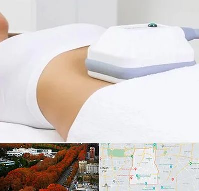 لاغری موضعی در منطقه 6 تهران 