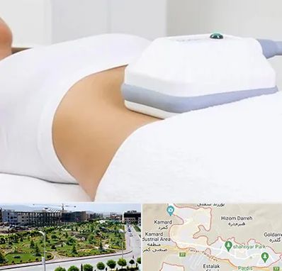 لاغری موضعی در پردیس