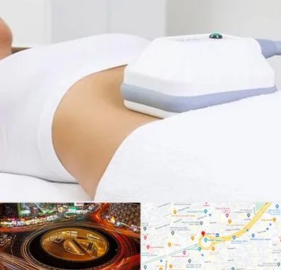 لاغری موضعی در میدان ولیعصر 