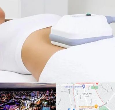 لاغری موضعی در گلسار رشت 