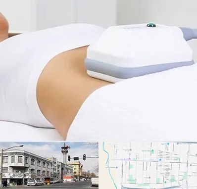 لاغری موضعی در 17شهریور