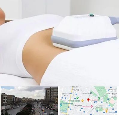 لاغری موضعی در بلوار فردوسی مشهد 