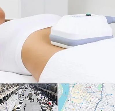 لاغری موضعی در نادری اهواز 