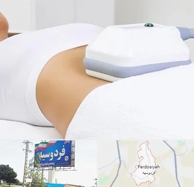 لاغری موضعی در فردوسیه شهریار