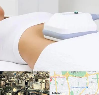 لاغری موضعی در مرزداران 