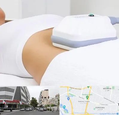 لاغری موضعی در بلوار فردوس 