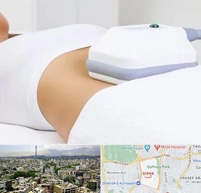 لاغری موضعی در گیشا 