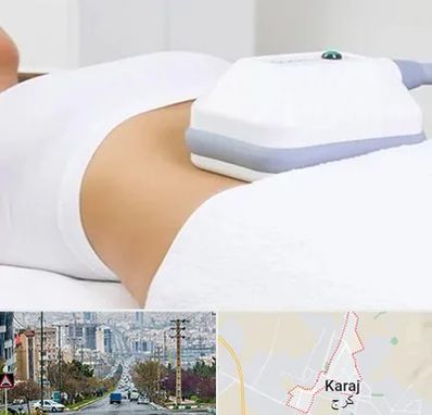 لاغری موضعی در گوهردشت کرج 