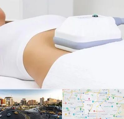 لاغری موضعی در منطقه 7 تهران 