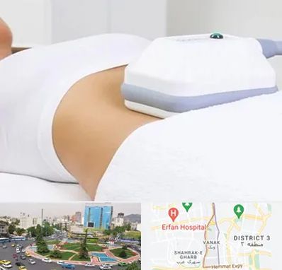 لاغری موضعی در ونک 