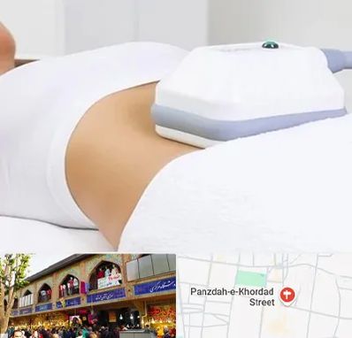 لاغری موضعی در 15 خرداد