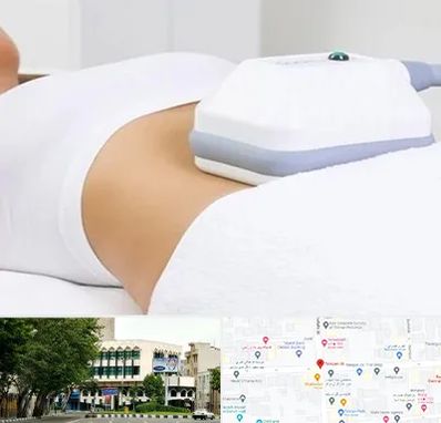 لاغری موضعی در طالقانی 