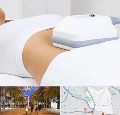 لاغری موضعی در ولیعصر ارومیه