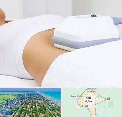 لاغری موضعی در ساری