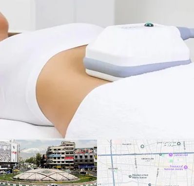 لاغری موضعی در مرکز تهران