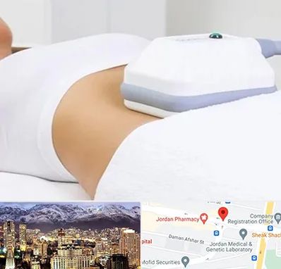 لاغری موضعی در جردن 