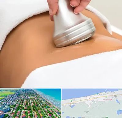 دستگاه لاغری در فریدونکنار