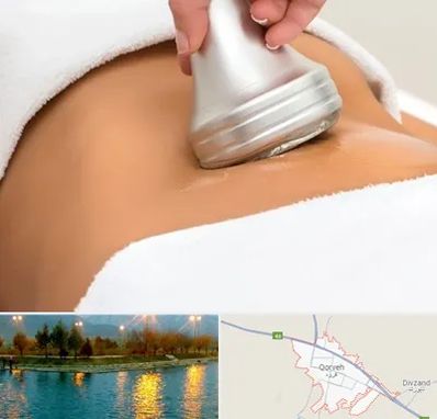 دستگاه لاغری در قروه