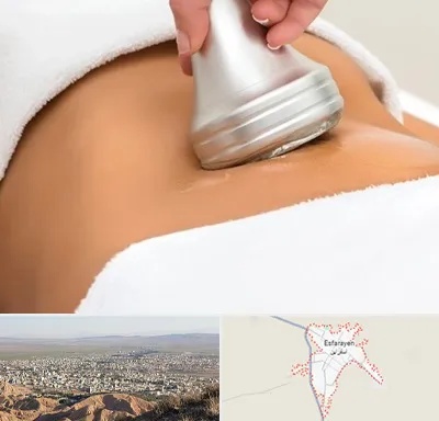 دستگاه لاغری در اسفراین