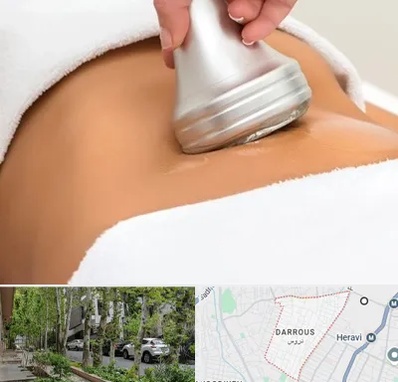 دستگاه لاغری در دروس