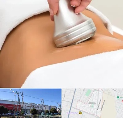 دستگاه لاغری در فاز دو اندیشه