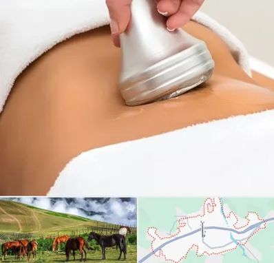 دستگاه لاغری در تالش