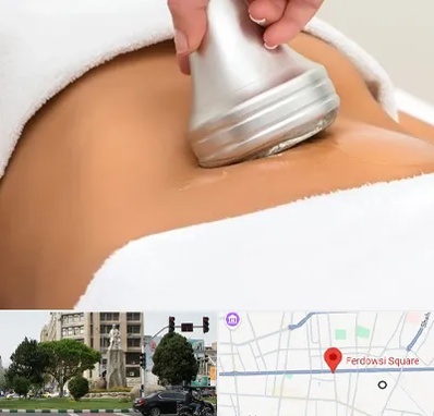 دستگاه لاغری در میدان فردوسی تهران