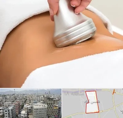 دستگاه لاغری در شمس آباد تهران
