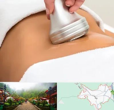 دستگاه لاغری در فومن