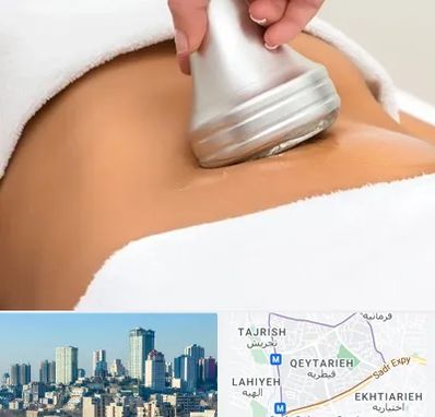 دستگاه لاغری در قیطریه 