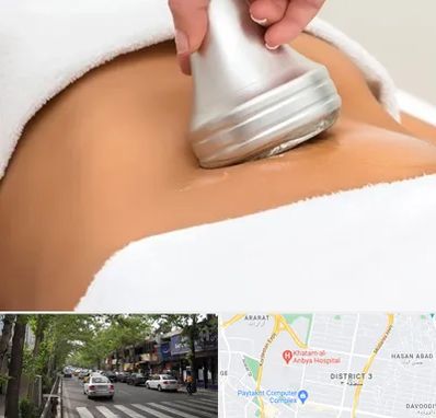 دستگاه لاغری در ظفر 