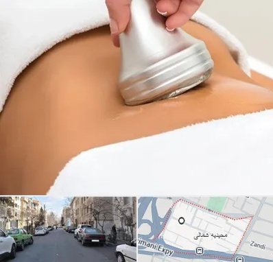 دستگاه لاغری در مجیدیه شمالی