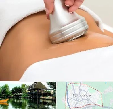 دستگاه لاغری در صومعه سرا