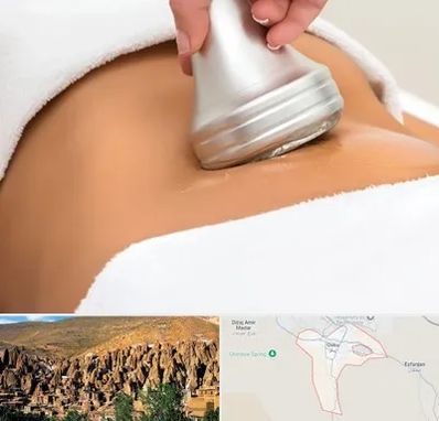 دستگاه لاغری در اسکو