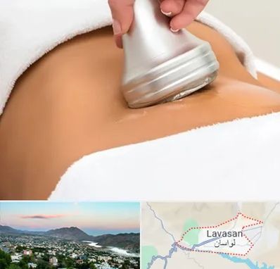 دستگاه لاغری در لواسان