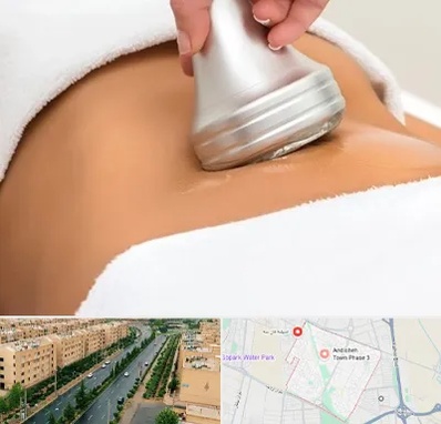 دستگاه لاغری در فاز سه اندیشه