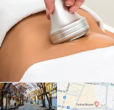 دستگاه لاغری در تربیت تبریز