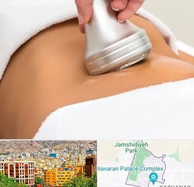 دستگاه لاغری در نیاوران 