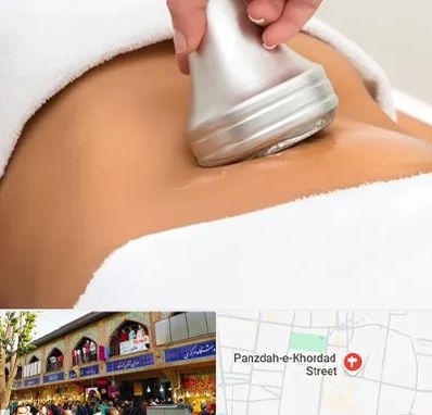 دستگاه لاغری در 15 خرداد